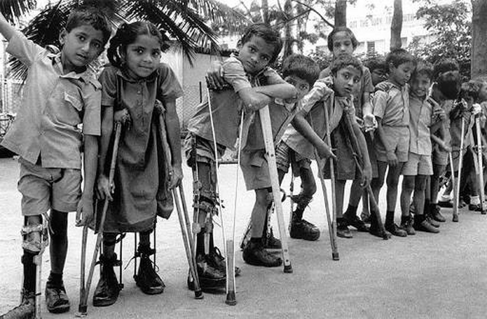 Detectan el primer caso de Polio en Israel luego de 33 años