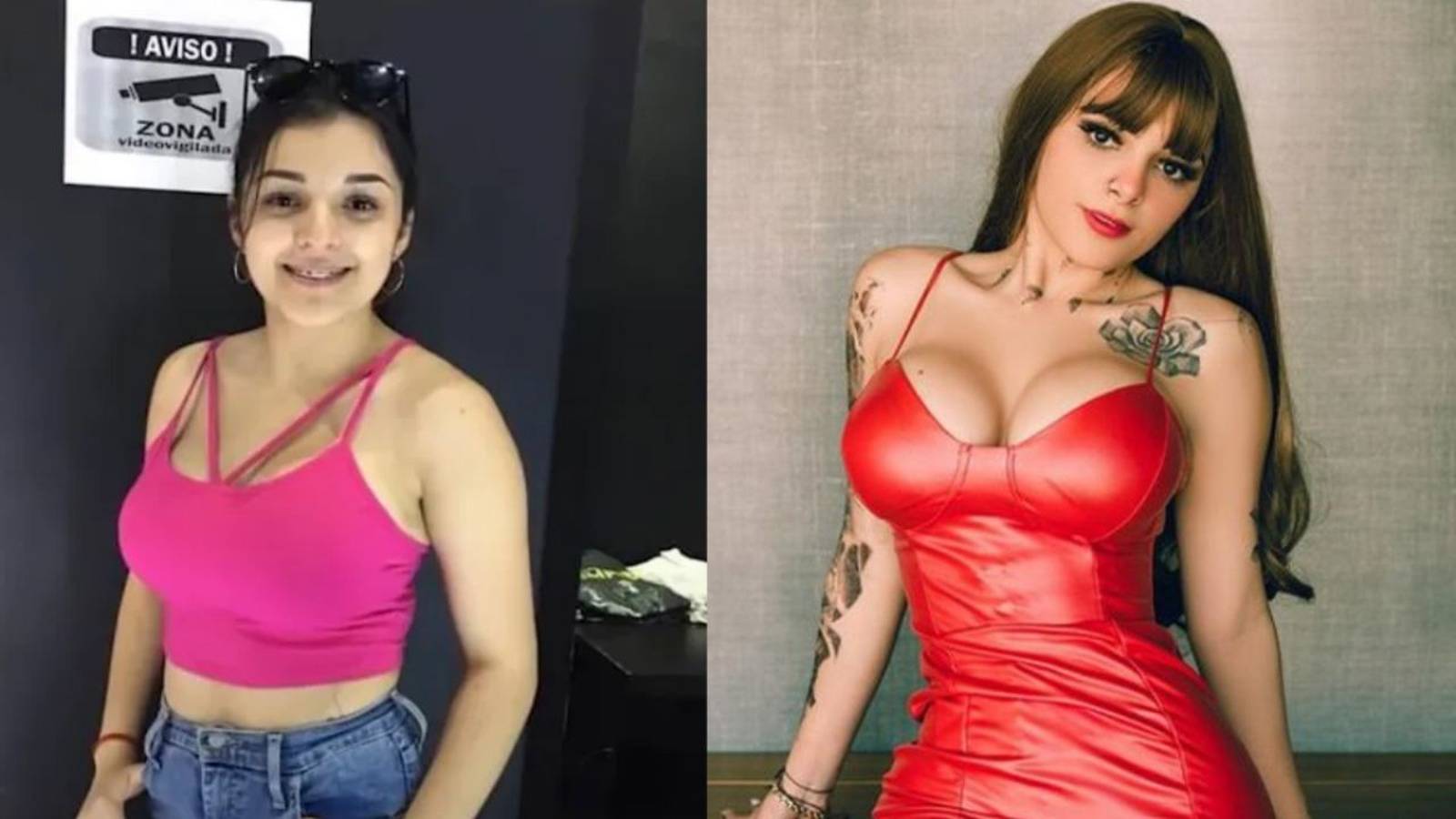 Cirujano “desnuda” A Karely Ruiz ¿cuánto Cuesta El Cuerpo De La Figura De Onlyfans Metro 9377