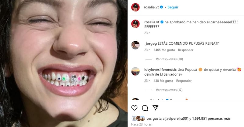 “Esto se va a descontrolar”: La arriesgada y sorprendente tendencia que adoptó la dentadura de Rosalía, ¿la intentarías?